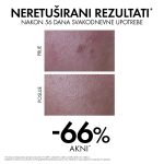 VICHY CAPITAL SOLEIL UV-CLEAR Fluid za zaštitu od sunca protiv nepravilnosti SPF50+, 40 ml - Image 10
