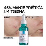 La Roche Posay EFFACLAR Protokol za odraslu kožu sklonu aknama i nepravilnostima (čišćenje, njega, zaštita od sunca) - Image 3